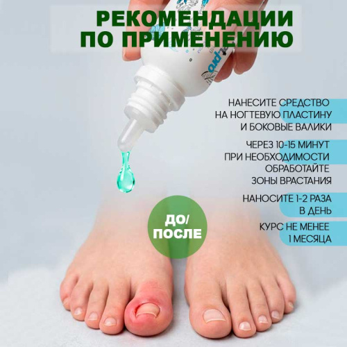 Средство против вросшего ногтя с охлаждающим эффектом 18 мл. KERATOLITIK18-MINT фото 2